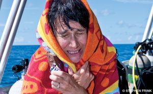 hypothermia